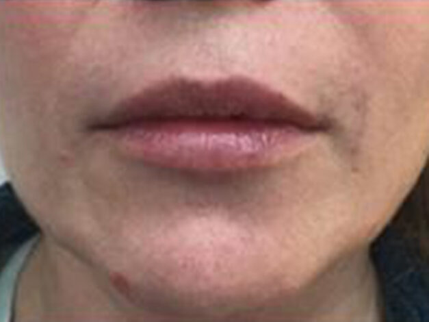 Case # 6 after photo