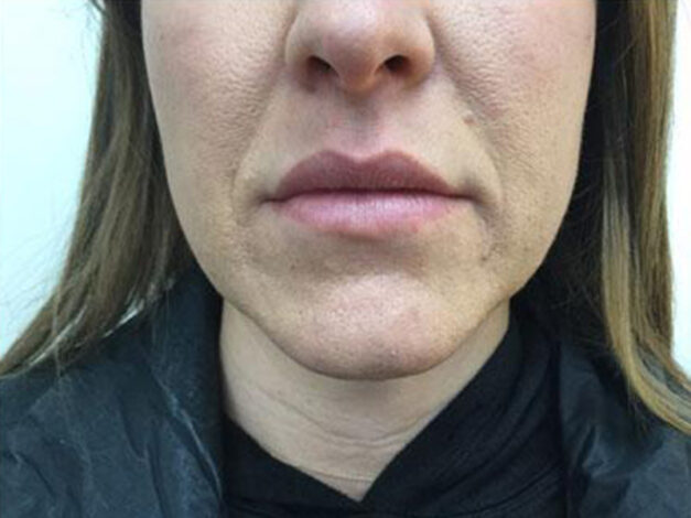 Case # 7 before photo