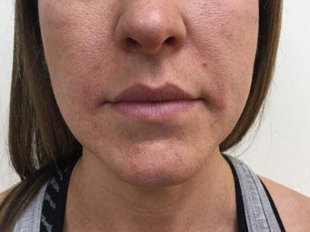 Case # 7 after photo