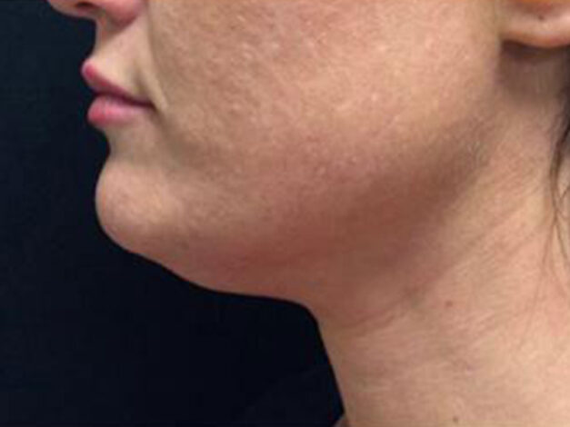 Case # 2 before photo