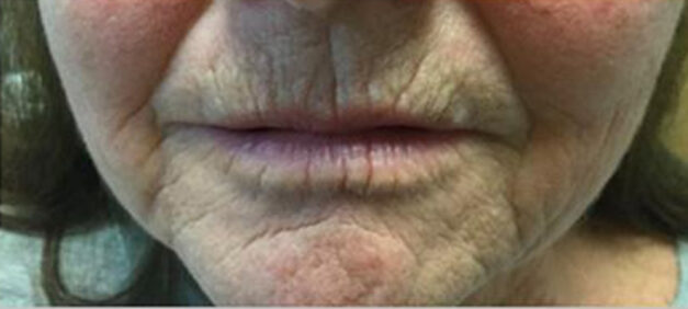 Case # 1 before photo