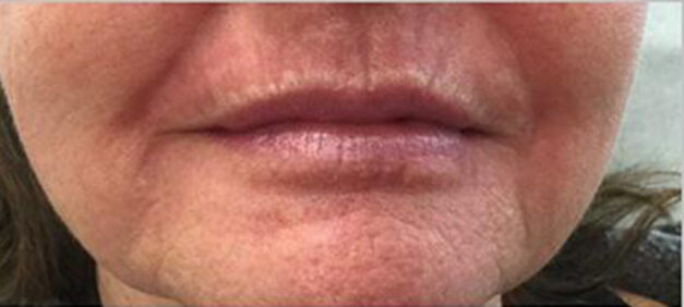 Case # 5 before photo