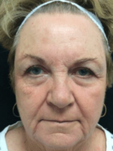 Case # 7 after photo