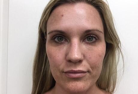 Case # 1 before photo