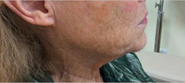 Case # 3 before photo