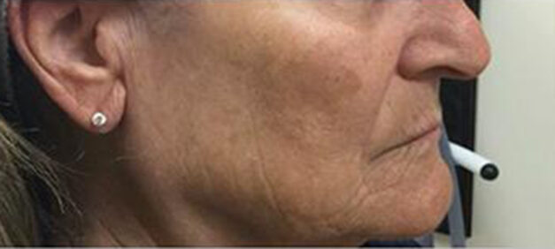 Case # 4 before photo