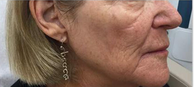 Case # 5 after photo