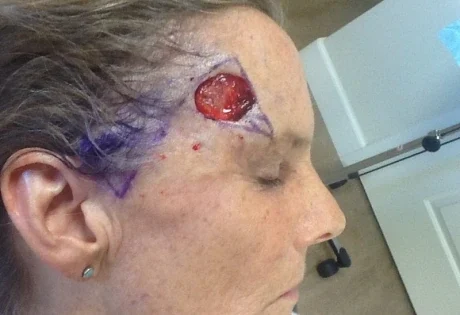 Case # 34 before photo