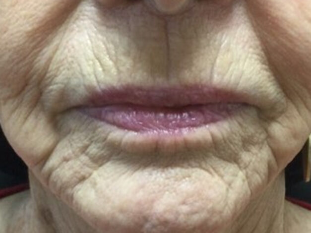 Case # 1 before photo