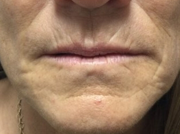 Case # 2 before photo