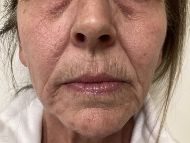 Case # 8 before photo