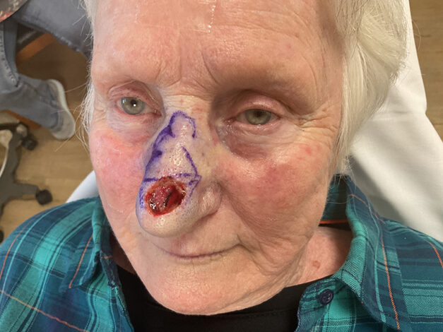 Case # 36 before photo