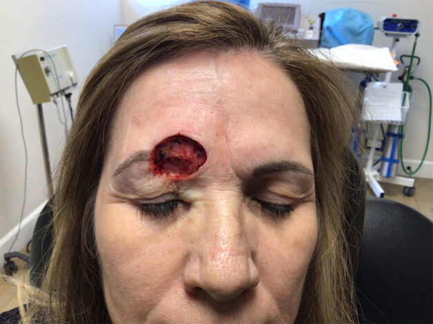 Case # 37 before photo