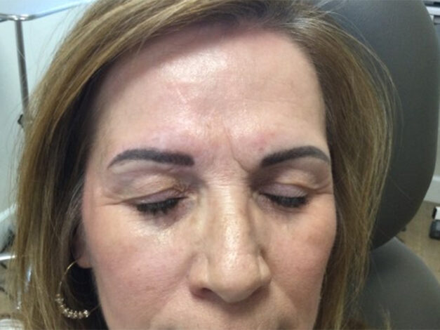 Case # 37 after photo