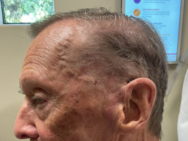 Case # 38 after photo